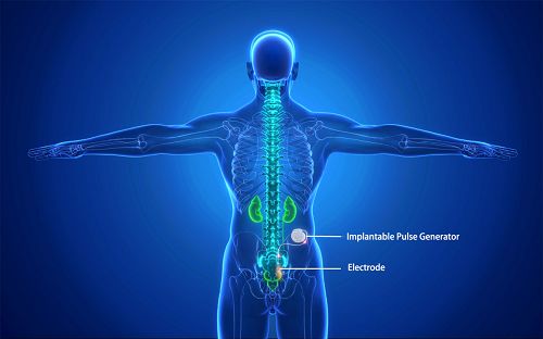 Causes du syndrome de douleur du plancher pelvien
